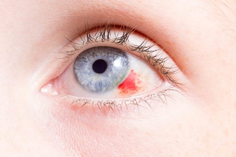eye injury hazard