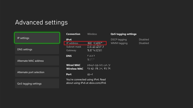 The advanced settings showing the IP address of the Xbox Series S