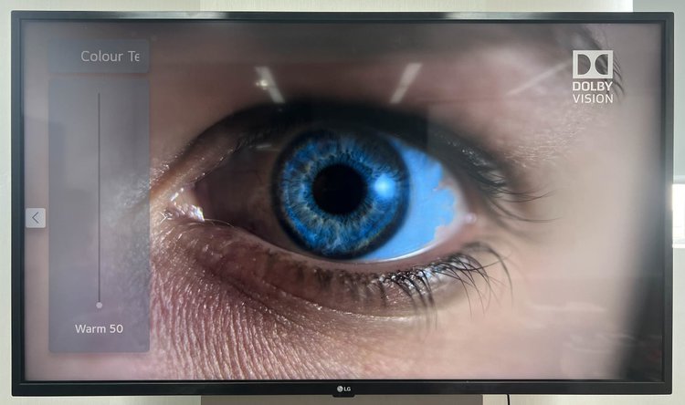 Why Does Your Dolby Vision Look Yellow? Solutions Revealed